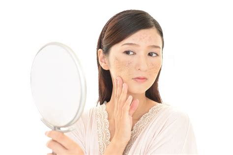 Most Effective And Proven Acne Scar Treatments M Aesthetic Clinic