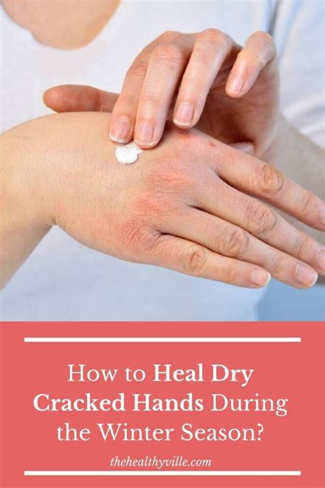 How To Heal Dry Cracked Hands That Happened Due To The Cold In Winter