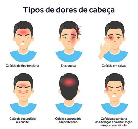 dor de cabeça principais causas tipos e tratamentos dorflex