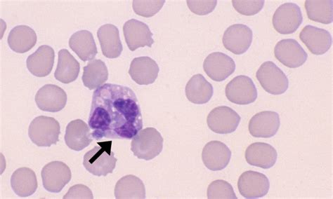 Eosinophils Cells And Smears