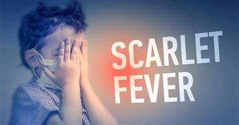 10 Symptoms And Treatments Of Scarlet Fever Facty Health