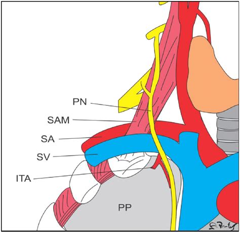 Phrenic Nerve Passing Anterior To The Subclavian Vein Pn Phrenic