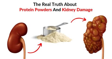 The Real Truth About Protein Powders And Kidney Damage ...