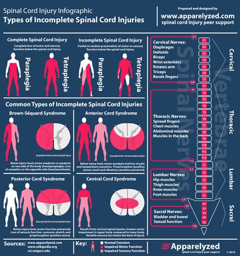 Types Of Spinal Cord Injuries Faculty Of Medicine