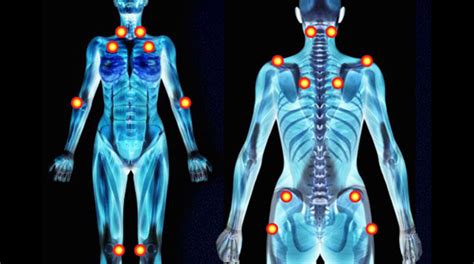 The term cervical refers to your neck. Healthiculture - Tender Point VS Trigger Point, What is ...