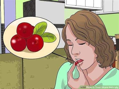 Stomach ulcers are also known as how do i get this natural cure for ulcer treatment? How to Treat Ulcers Naturally (with Pictures) - wikiHow
