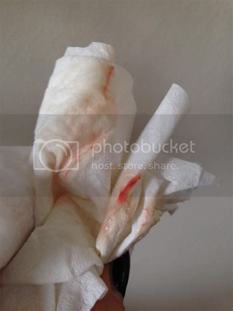 What Does Implantation Bleeding Look Like On A Tampon Maternity Photos
