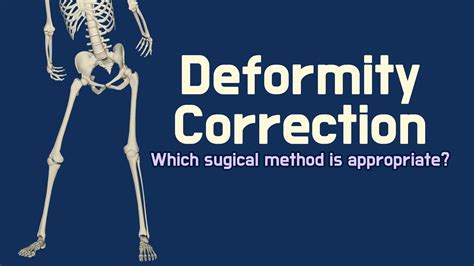 Deformity Correction How To Know The Appropriate Surgical Method