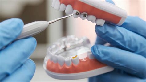 Pin En Ortodoncia ClÍnica Dental Goi