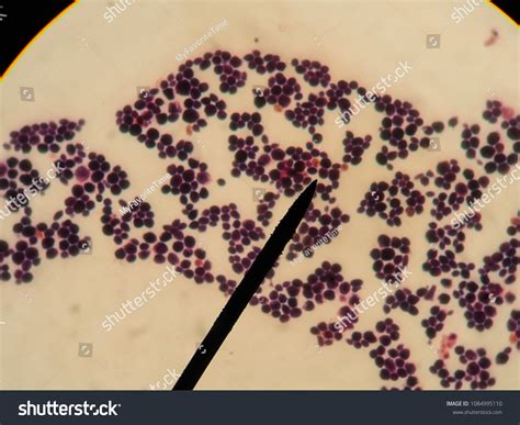 Yeast Budding Yeast Candida Albicans Staining Stock Photo 1084995110