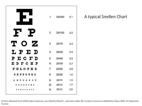 Eye See How Your Eyes Work And Why You Might Need Glasses