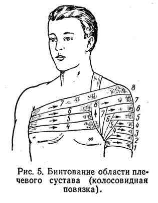 Когда и для чего используются повязки. Колосовидная повязка на плечевой сустав техника: бинт на плечо