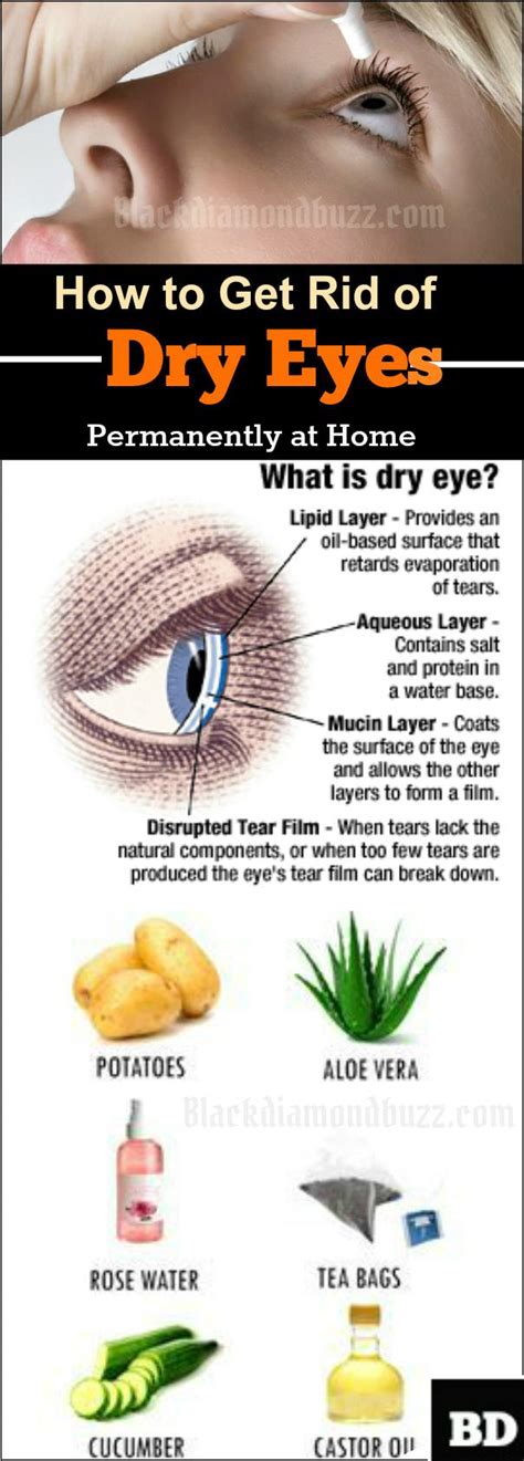 Best Home Remedies For Dry Eyes Relief Get Rid Of Dry Eye Fast