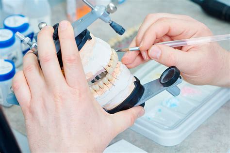 Tipos De Puentes Dentales Diferencias Y Beneficios Adeslas Dental