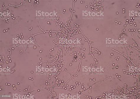 Budding Yeast Cells With Pseudohyphae In Urine Sample Stock Photo