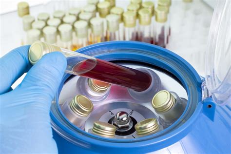 Centrifuging Blood And Biological Samples Aletra Capital Partners Bv