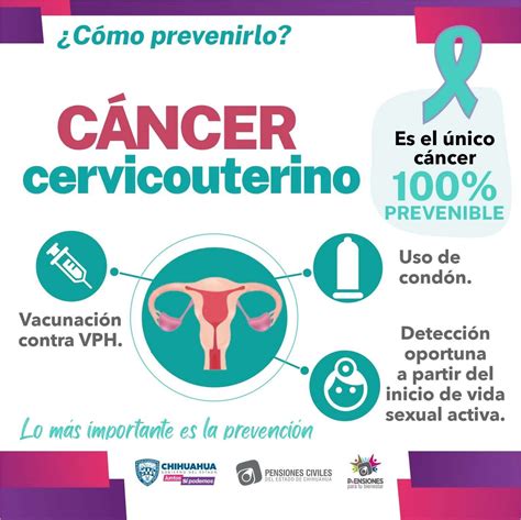 Invitan A Mujeres A Detectar Y Prevenir El Cáncer Cervicouterino La