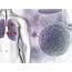 Common Signs And Symptoms Of Lung Cancer
