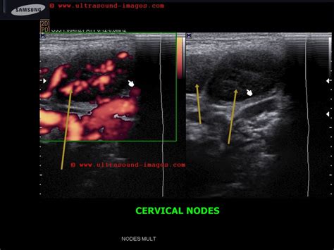 A Gallery Of High Resolution Ultrasound Color Doppler And 3d Images