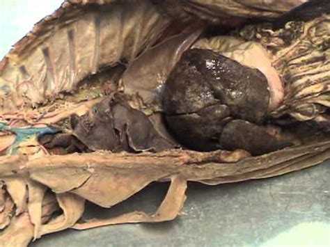 Digestive System - YouTube
