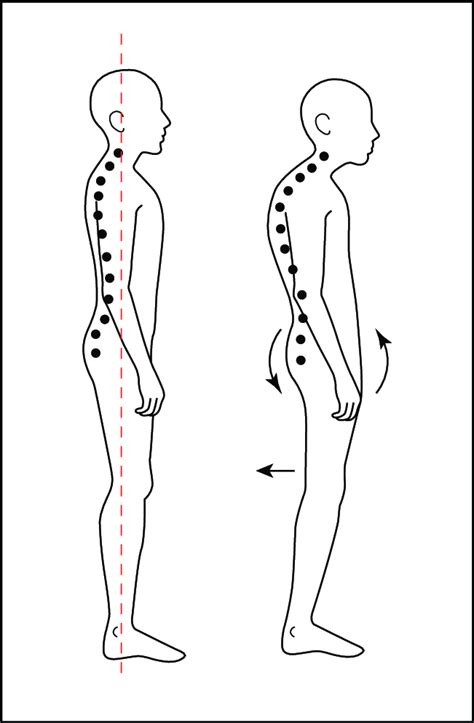 Illustration Showing The Conventional Standing Position Posture And Download Scientific Diagram
