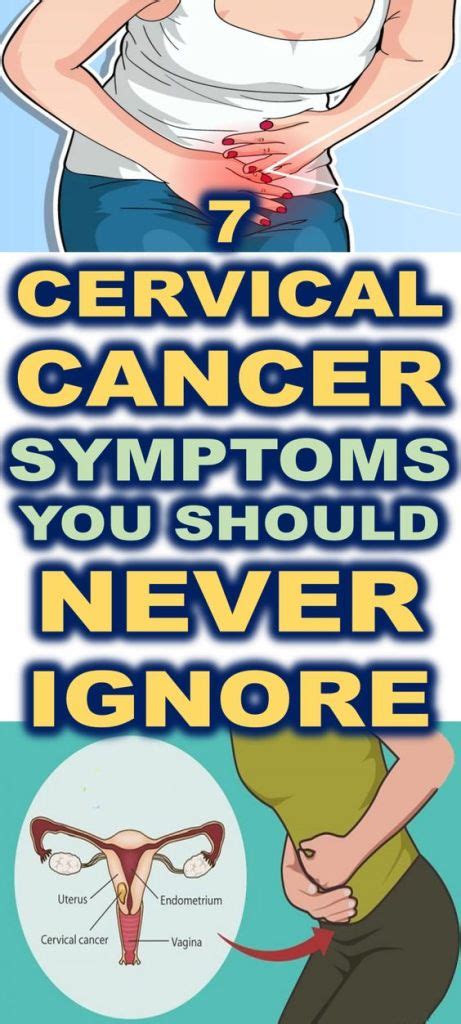 Here Are 7 Cervical Cancer Symptoms You Should Never Ignore ~ Krobknea