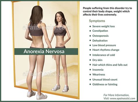 Anorexia Nervosacausessignssymptomstreatmenttypes