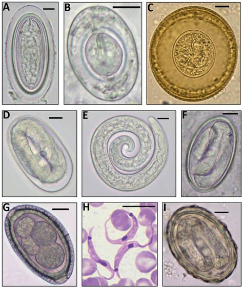 Helminth Eggs And Larva And The Protozoan Blood Parasite Found Scale
