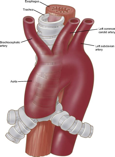 Figure 1 From Anatomy Of The Thoracic Aorta And Of Its Branches