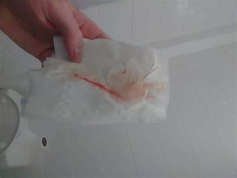 Possible Implantation Bleeding Tmi Photo