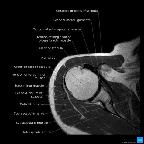 Normal Shoulder MRI How To Read A Shoulder MRI Kenhub