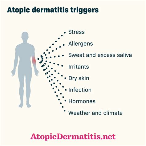 What Are Common Eczema Triggers