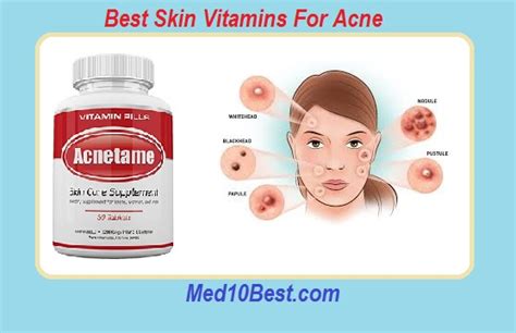 Best Skin Vitamins For Acne 2021 Top 10 Buyers Guide