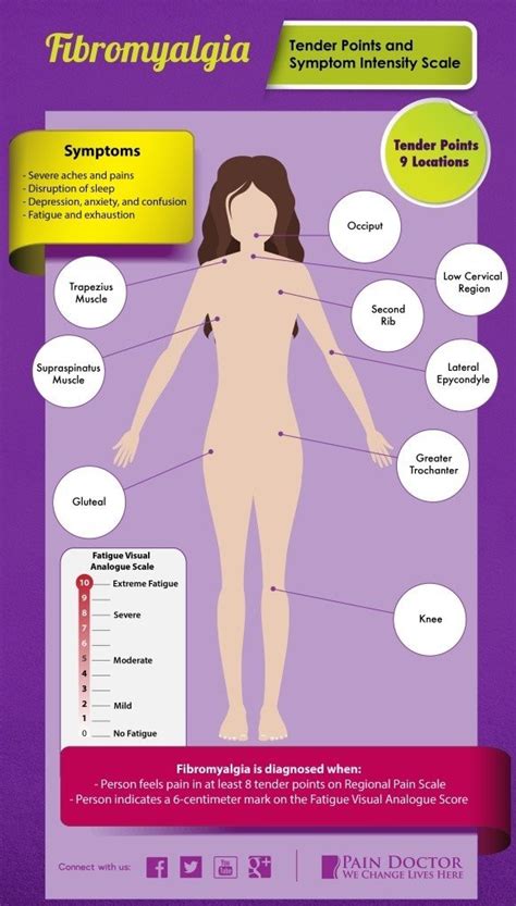 50 Signs Of Fibromyalgia