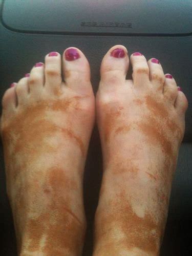 Erin Andrewss Feet