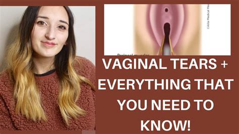 Vaginal Tearing How To Prevent Perineal Tears 3rd 4th Degree YouTube