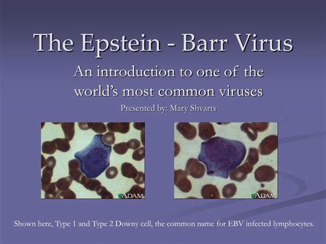 Ppt The Epstein Barr Virus Powerpoint Presentation Id276912
