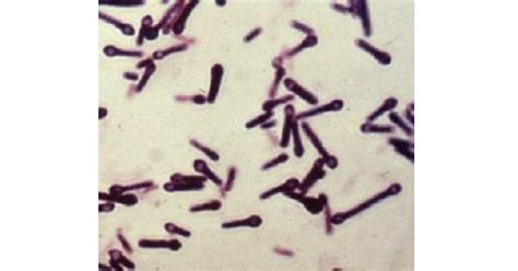 Clostridium Tetani New