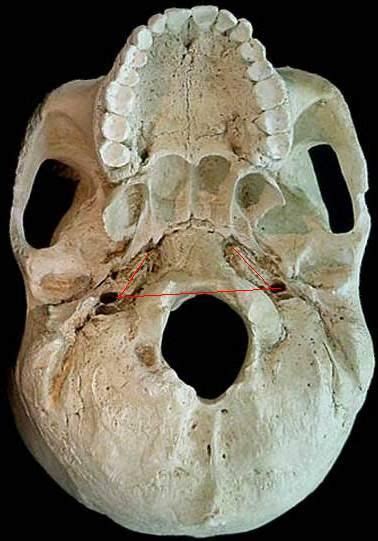 The Foramen Magnum How Do We Know Human Skull Skull Hominid