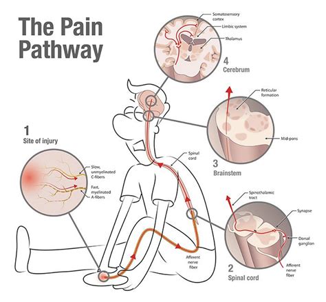 The Pain Pathway Infographic Low Back Pain Pinterest Pain D