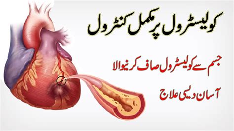 Suivez l'évolution de l'épidémie de coronavirus / covid19 dans le monde. Cholesterol Kam Karne Ke Gharelu Ilaj In Urdu | How to control cholesterol In Urdu/Hindi - YouTube