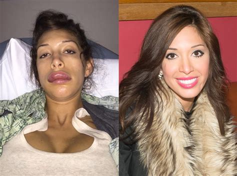 Were Farrah Abrahams Botched Lip Injections Magically Fixed E Online Uk