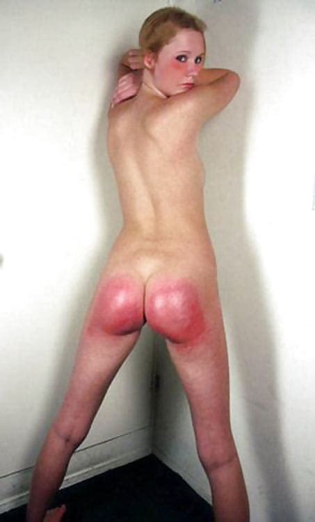 My Butt After Spanking