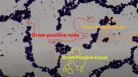 Gram Positive Cocci Rods And Yeast Cells Under The Microscope Youtube