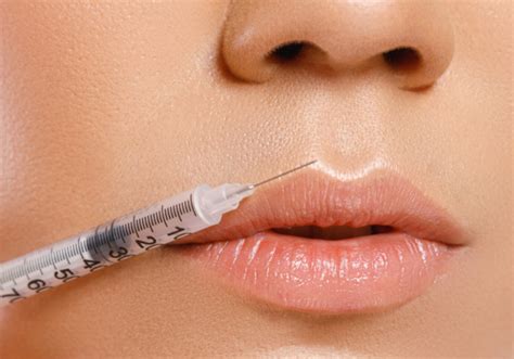 Best Lip Injections Dermal Fillers Mclean Cosmetic Dermatology Center