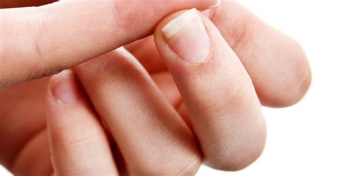 Type 2 Diabetes Symptom Appearing On Your Nails Signs To Spot And