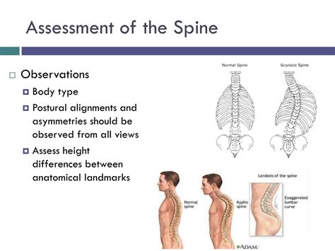 Ppt Chapter 20 The Spine Powerpoint Presentation Free Download Id
