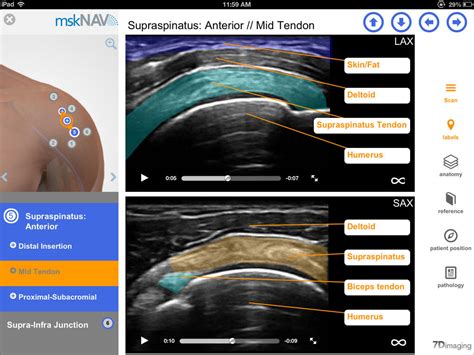 Msknav Is A Great Medical App For Learning Msk Ultrasound Imedicalapps