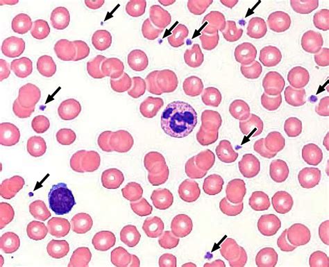 View 14 Blood Smear Slide Labeled Leukocyte Designcarefulinterest
