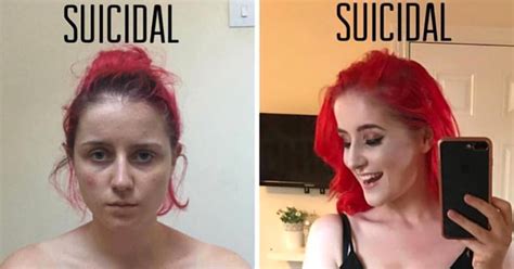 Suicide Womans Post About Not Looking Suicidal Goes Viral